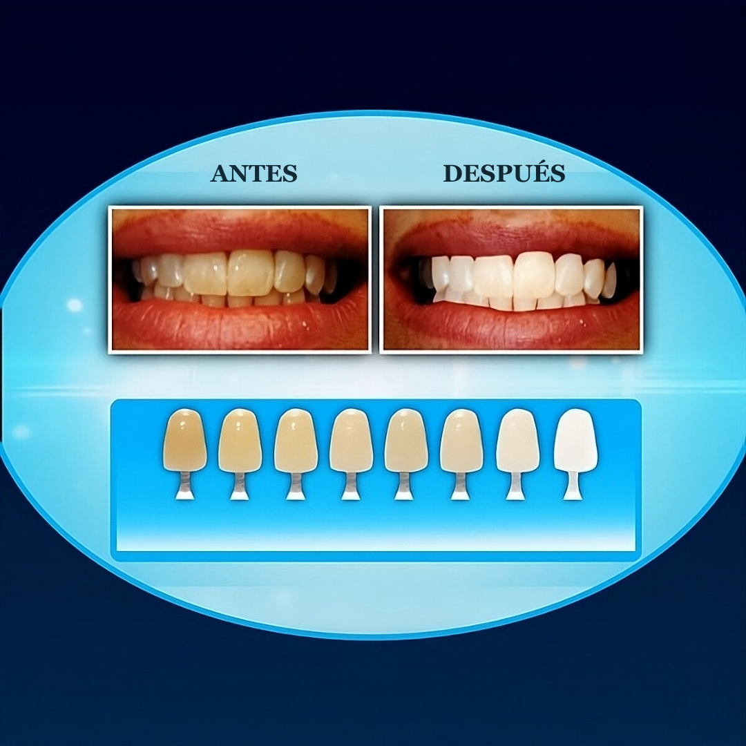 LumiSmile Kit Blanqueador Dental UV - [PROMOCIÓN DISPONIBLE SOLO HOY]